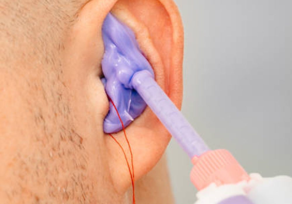 IMG_5168 Process of making earplug from an impression of an individual s human ear. Ear close-up. Personally molded earplugs. Solution for noisy places. Part of the set